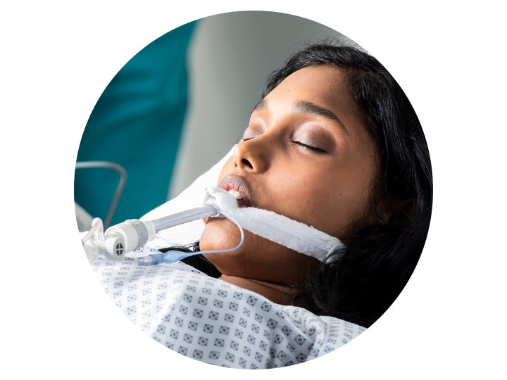Shown from the shoulders up, a young, female patient lying in a hospital bed, eyes closed, intubated with an endotracheal tube