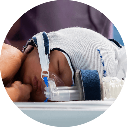 Infant receiving respiratory support with FlexiTrunk interface.