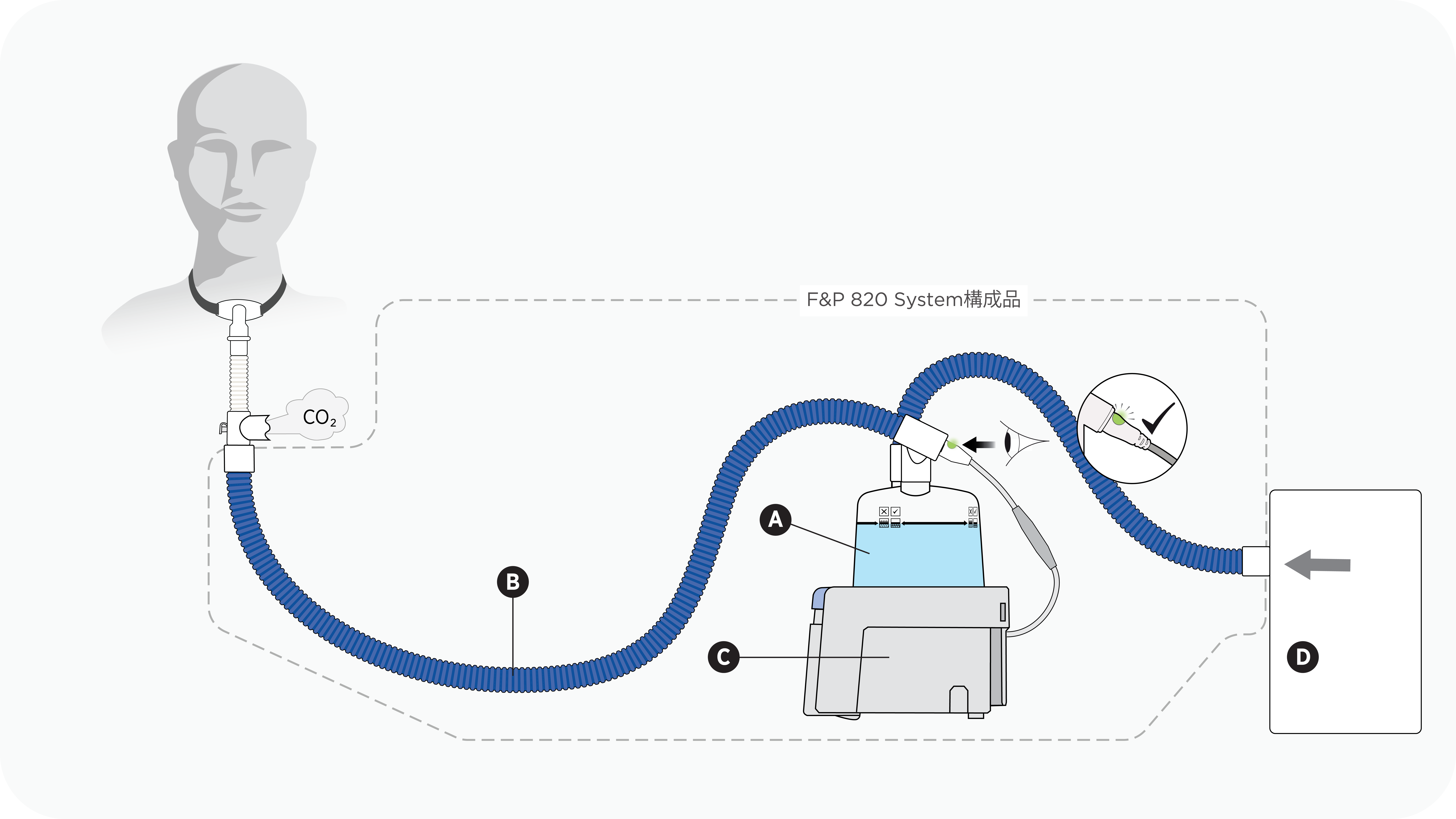F&P 820加温加湿器、シングル回路、および加湿チャンバーを使用した気管切開セットアップの図解