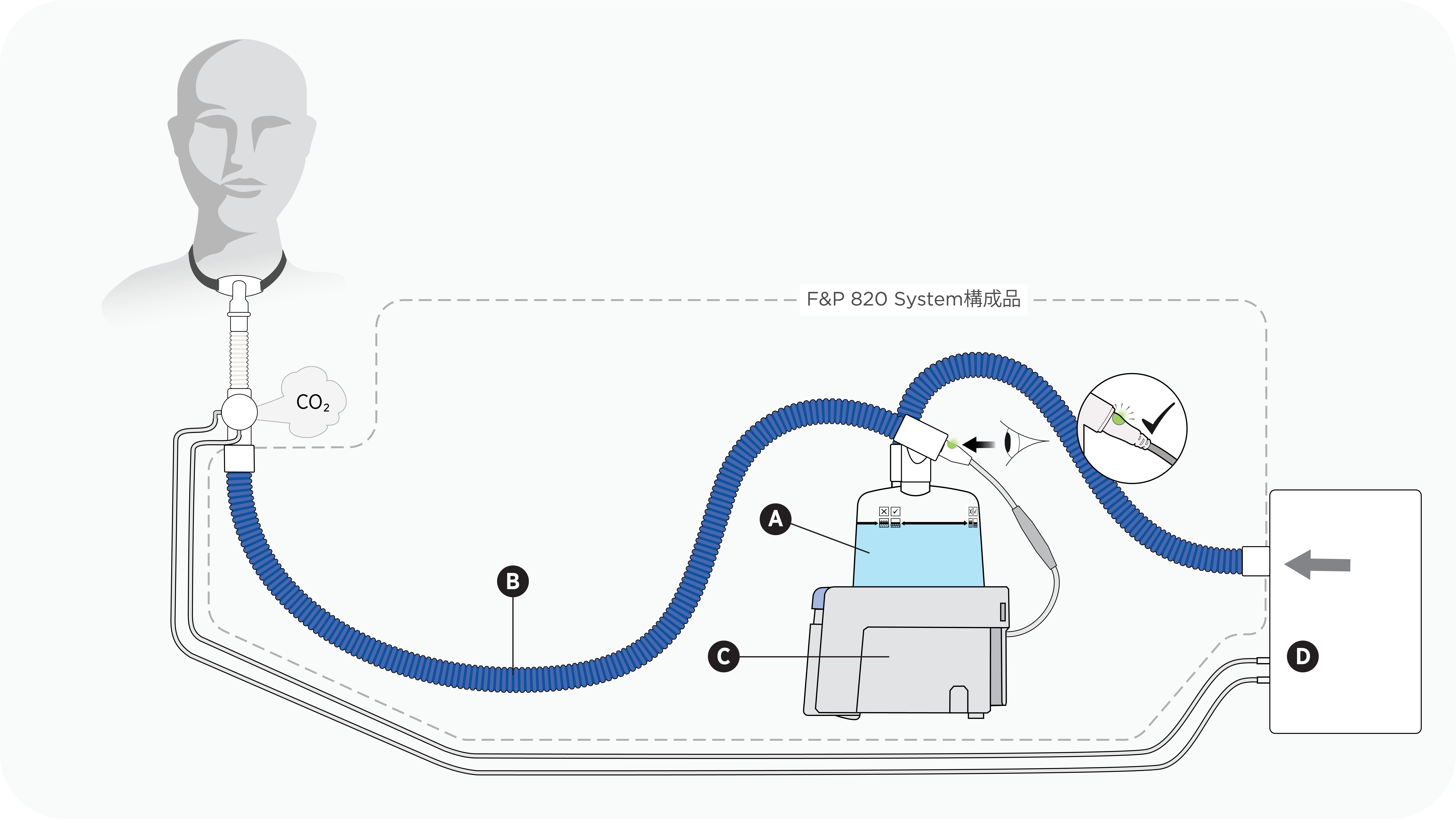 F&P 820加温加湿器本体、シングル回路、加湿チャンバー、および圧ラインを使用した気管切開セットアップの図解