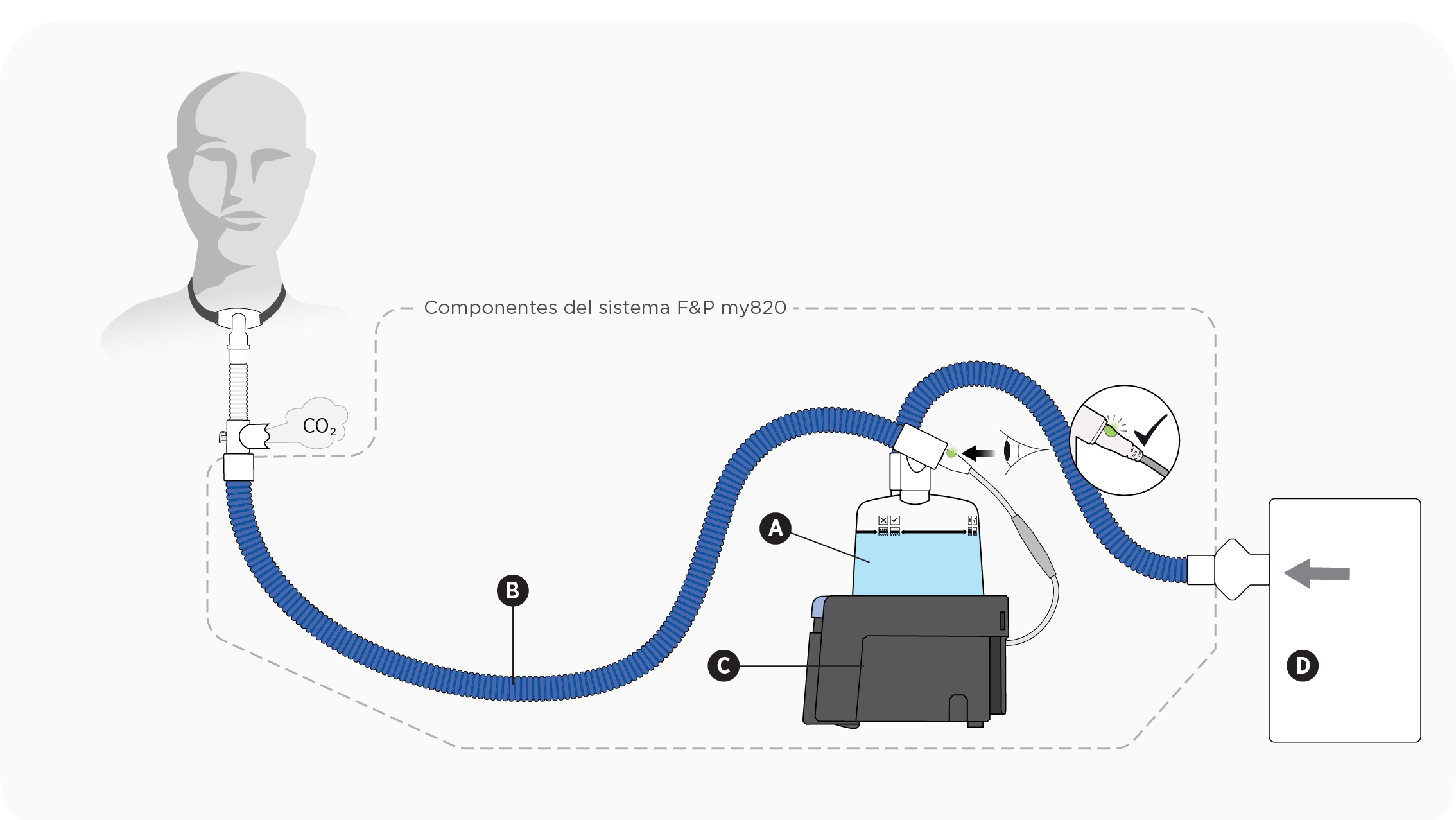 Esquema que muestra un equipo de traqueostomía que utiliza un puerto de exhalación pasiva con una base de calentamiento F&P my820, un tubo respiratorio y una cámara de humidificación