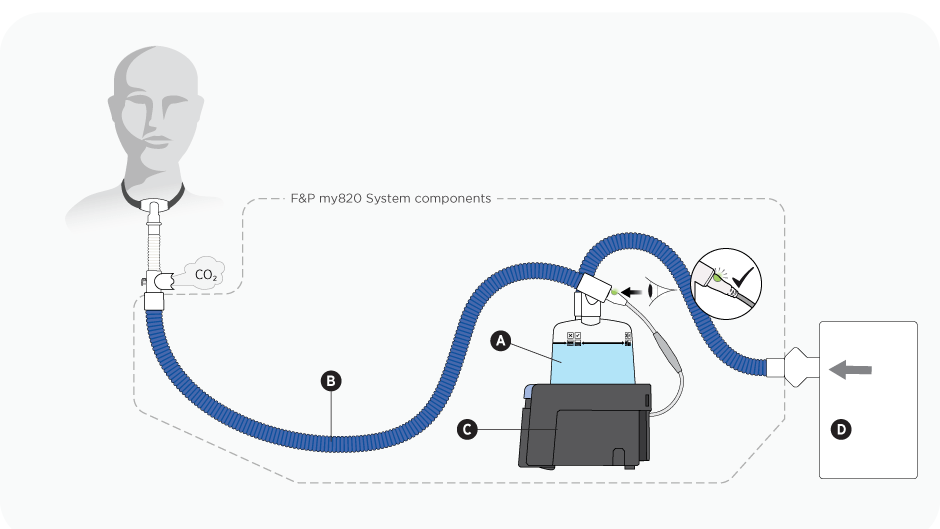 A diagram showing a tracheostomy set up using a passive exhalation port with an F&P my820 heater base, breathing tube and humidification chamber