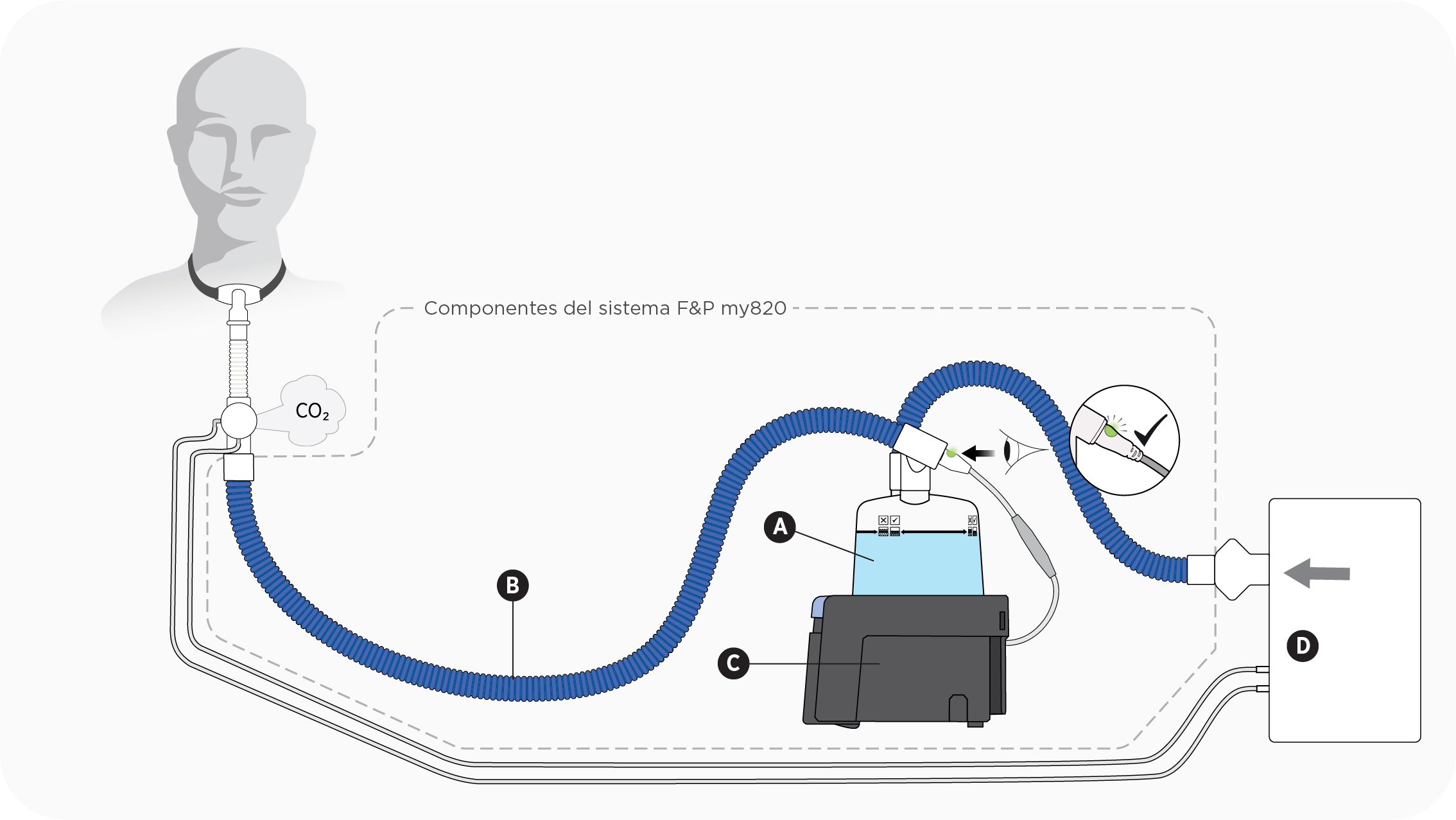 Esquema que muestra un equipo de traqueostomía que utiliza una válvula de exhalación activa con una base de calentamiento F&P my820, un tubo respiratorio y una cámara de humidificación