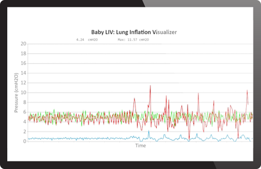 Infant Respiratory Care Continuum | Fisher & Paykel Healthcare
