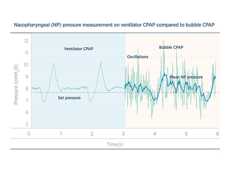 Le Bubble CPAP crée des oscillations de pression.