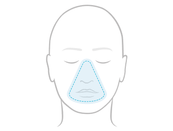 Line illustration of a face showing full-face over-the-nose mask coverage