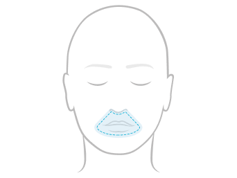 Line illustration of a face showing full-face under-the-nose mask coverage