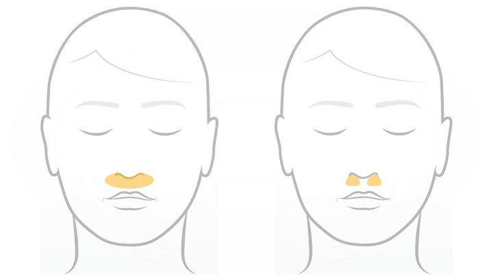 Una imagen que muestra que F&P Solo está incluida en la categoría de máscara nasal y almohadillas nasales.