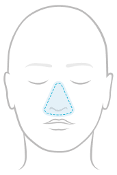 Line illustration of a face highlighting nasal over-the-nose mask coverage on and above the nose