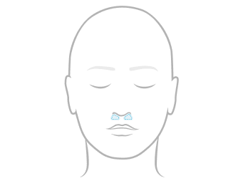 Line illustration of a face showing nasal pillows mask coverage