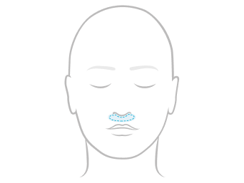 Line illustration of a face showing nasal under-the-nose mask coverage