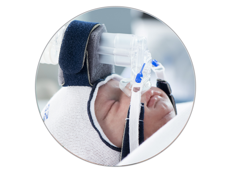F&P 950 System delivering CPAP therapy to neonate via a FlexiTrunk™ interface in hospital environment
