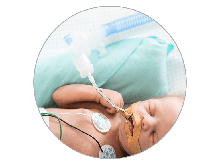 Infant Respiratory Invasive