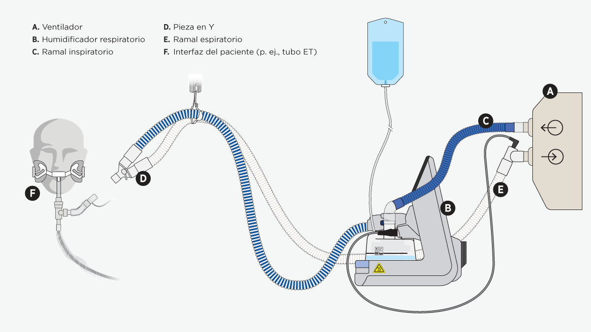 Sistema de ventilación invasiva con un humidificador con calor F&P 950 que calienta y humedece el aire que inspira el paciente.