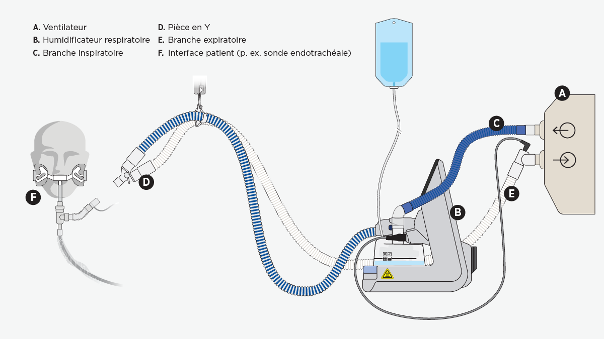 Un système de ventilation invasive intégrant un humidificateur chauffant F&P 950 qui réchauffe et humidifie l’air inspiré par un patient.