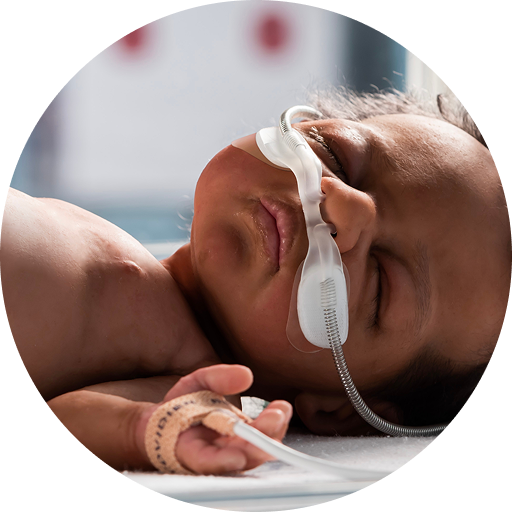 Infant receiving respiratory support with Optiflow Junior 2 nasal cannula.