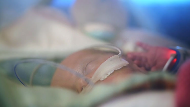 Noninvasive Interfaces in the NICU
