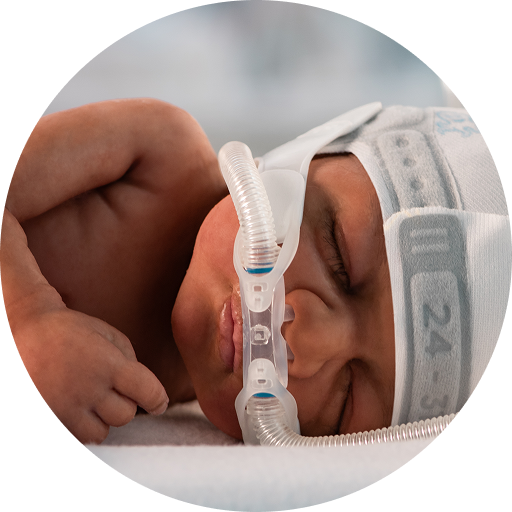 Infant receiving respiratory support with OptiPAP Junior.