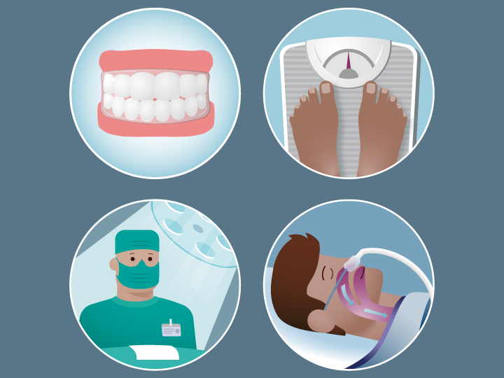 CPAP Alternatives Best Sleep Apnea Treatments Without CPAP Fisher