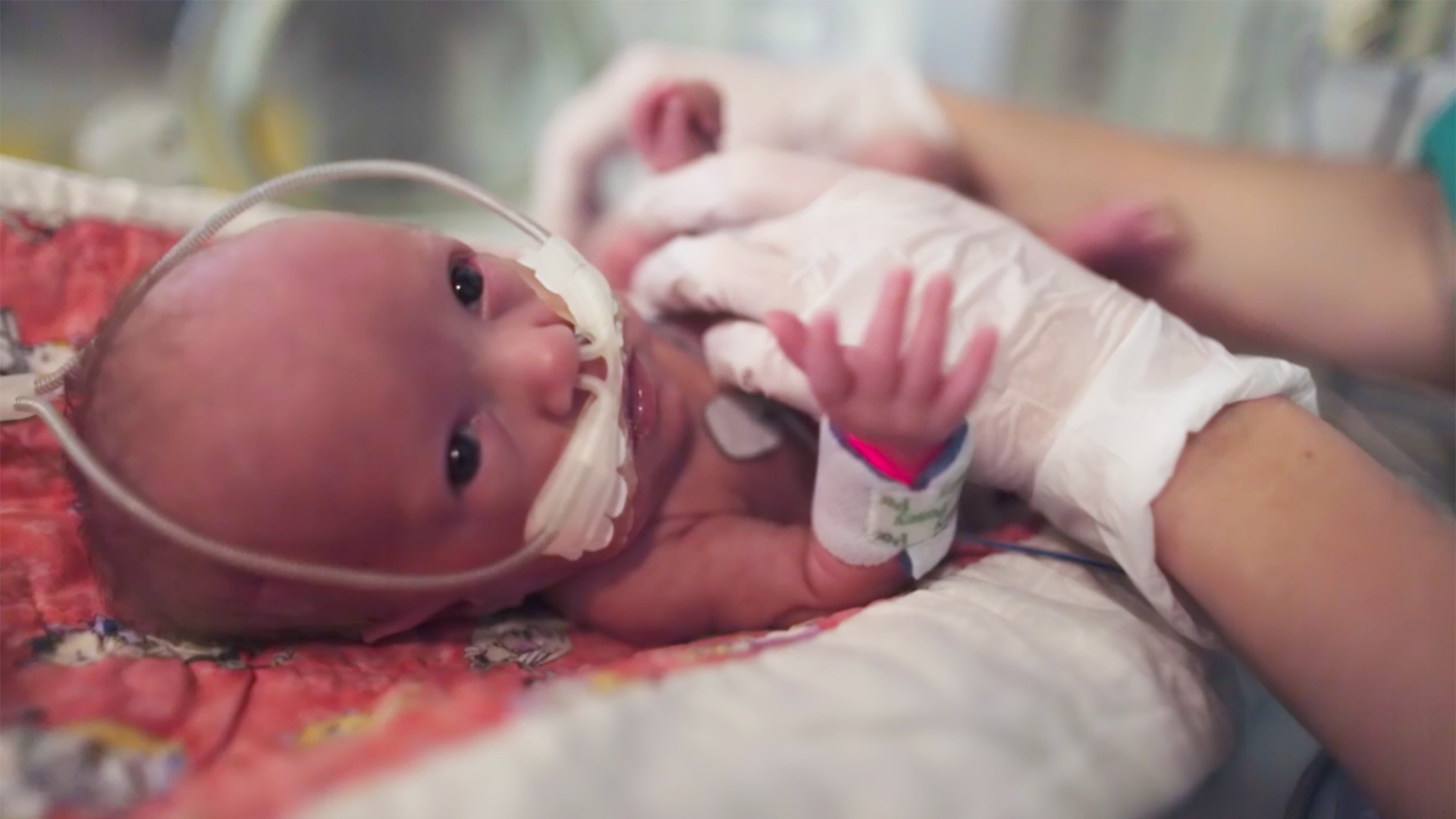 The impact of a new therapy at the Rosie