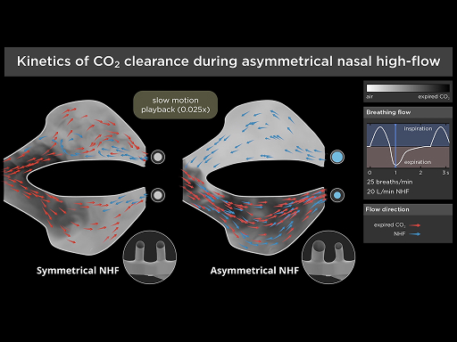 myAirvo Optiflow+ Duet CO2 clearance