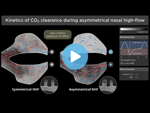 myAirvo Optiflow+ Duet CO2 clearance
