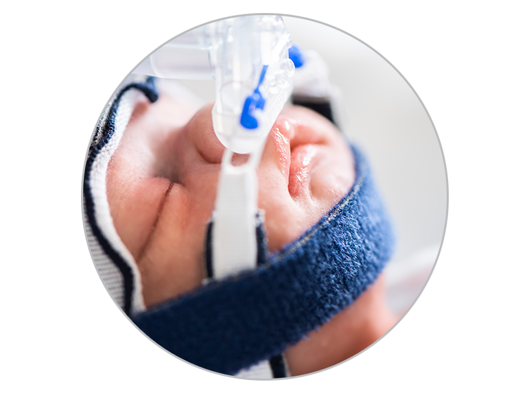 CPAP-Therapie für Säuglinge
