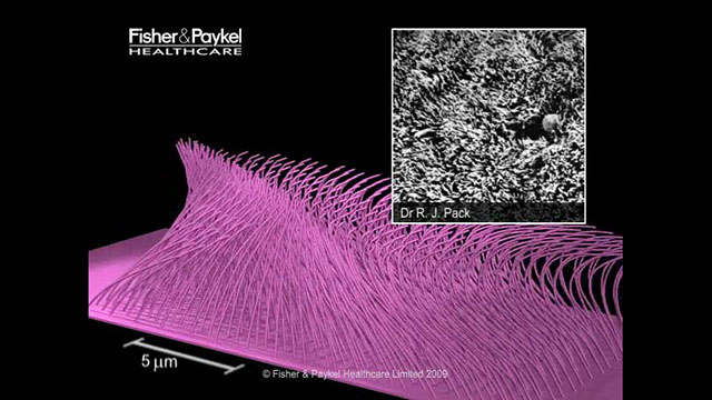 Introduction to Mucociliary Transport Video Microscopy
