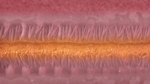 Desiccation of the Peritoneum and Cancer Cells